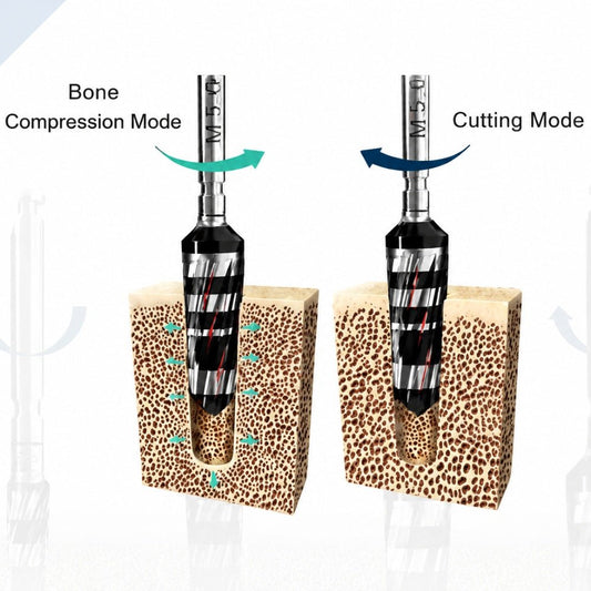 1.75 Smart Osseodensification Bur - eedas.com