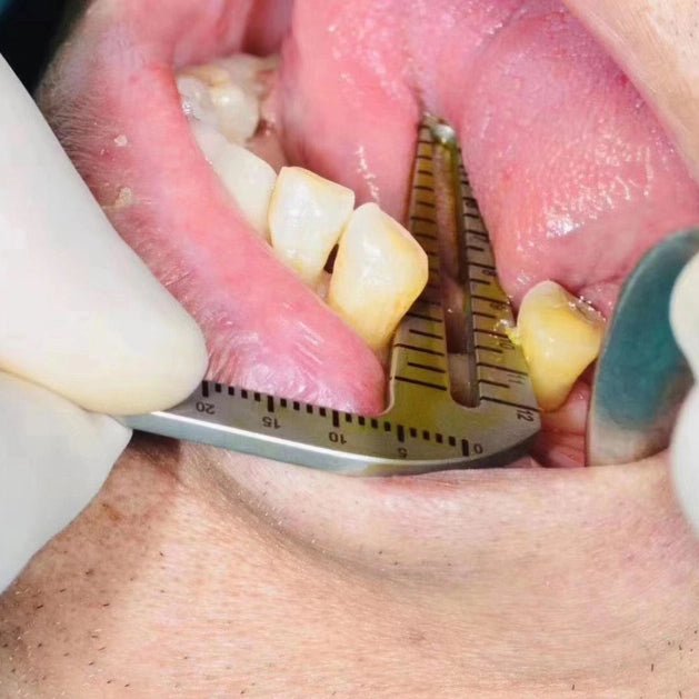 Dental Implant Positioning Guide Set - eedasdent